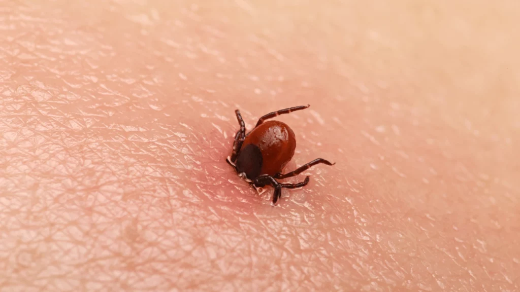 Usuwanie kleszczy Trójmiasto